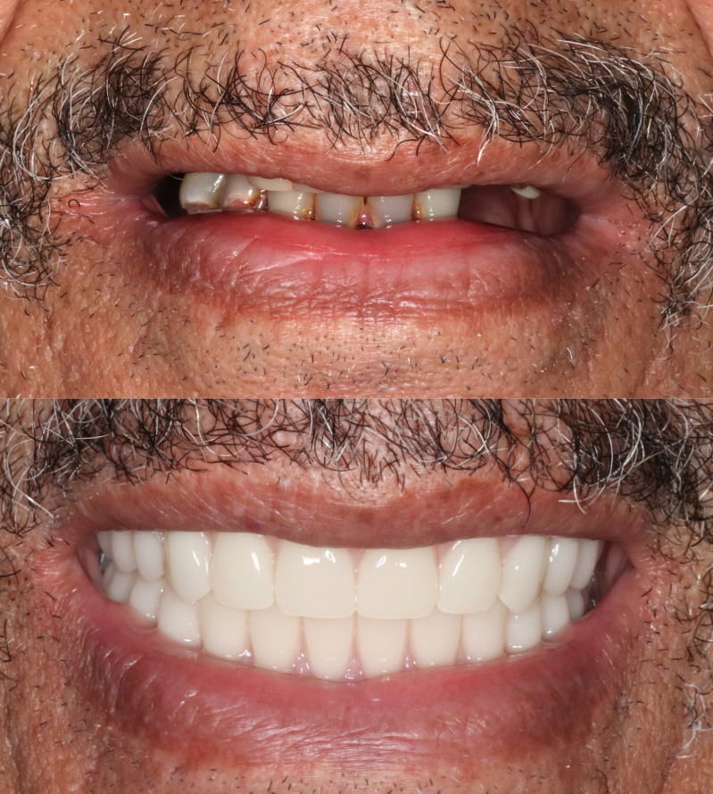 adv-reconstruction-case-1 - 1