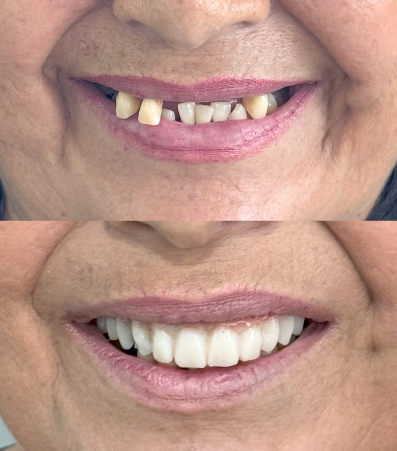 adv-reconstruction-case-2